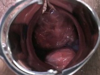 Signora incinta giapponese viene esaminato e succhia lollicock del doc